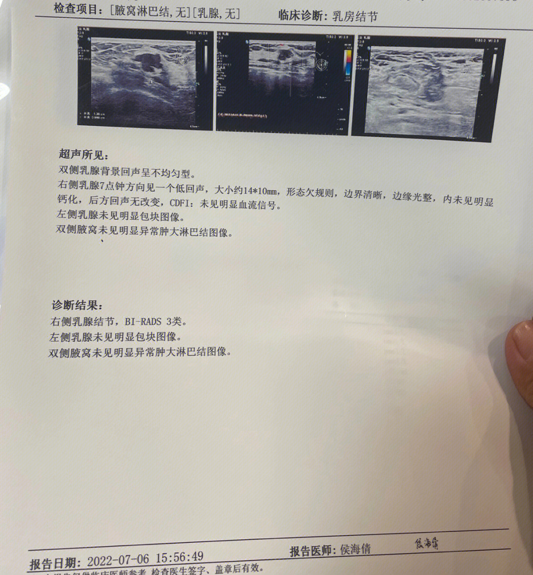 乳腺结节3级传统手术