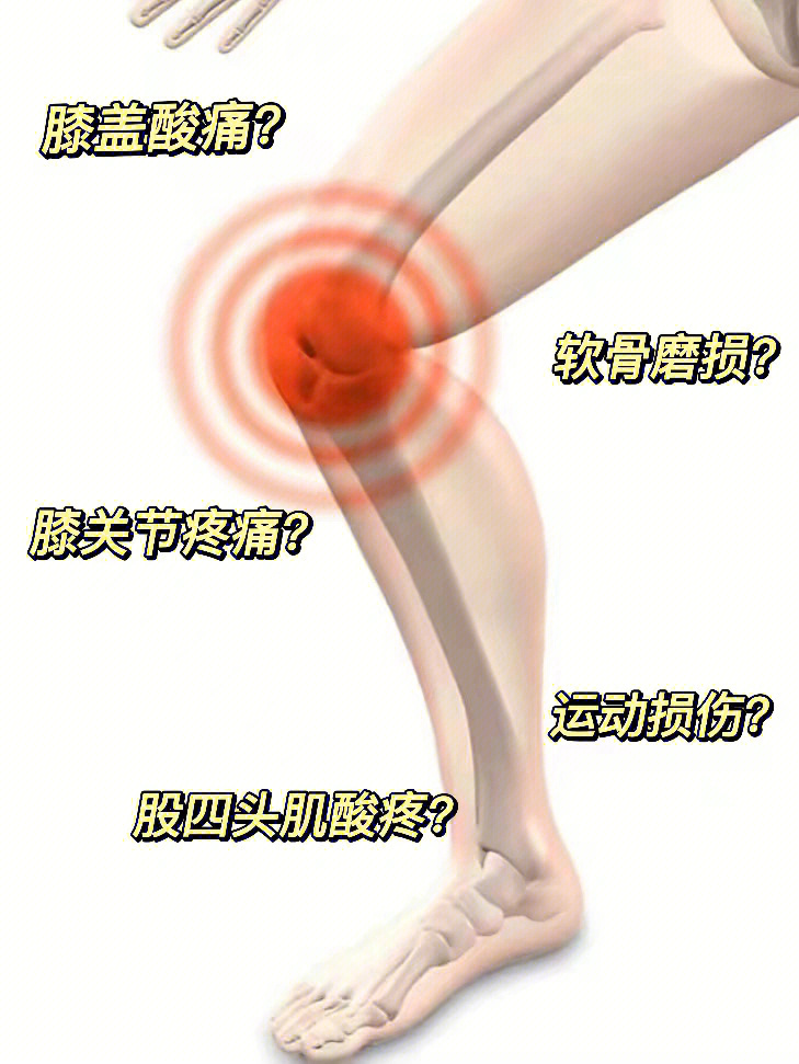 膝盖疼对应位置图图片