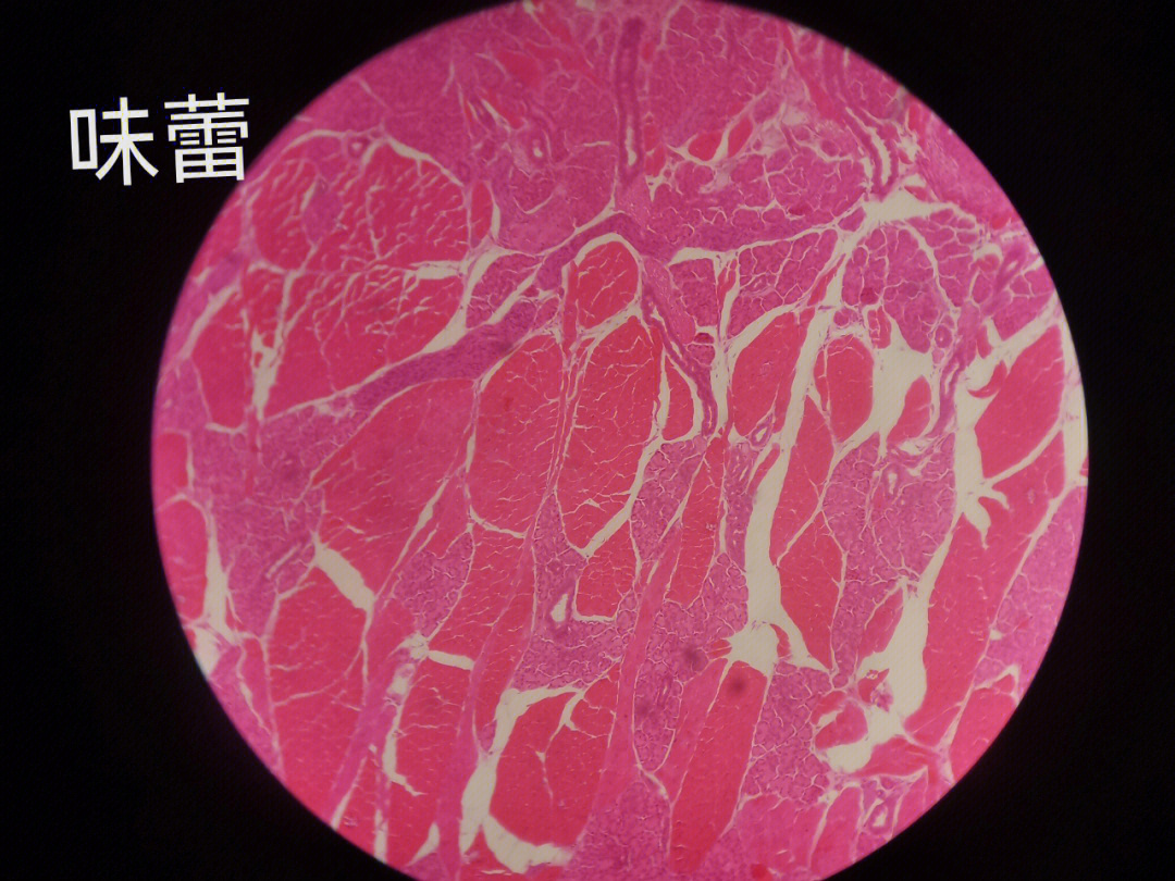 食管切片图 手绘图图片