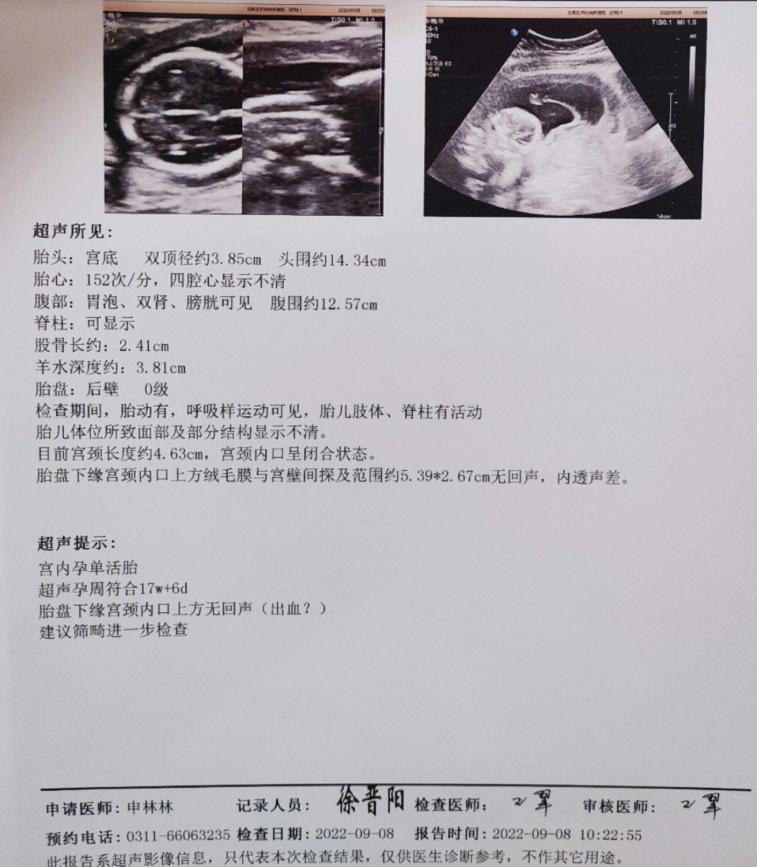 15周女孩17周男孩图片