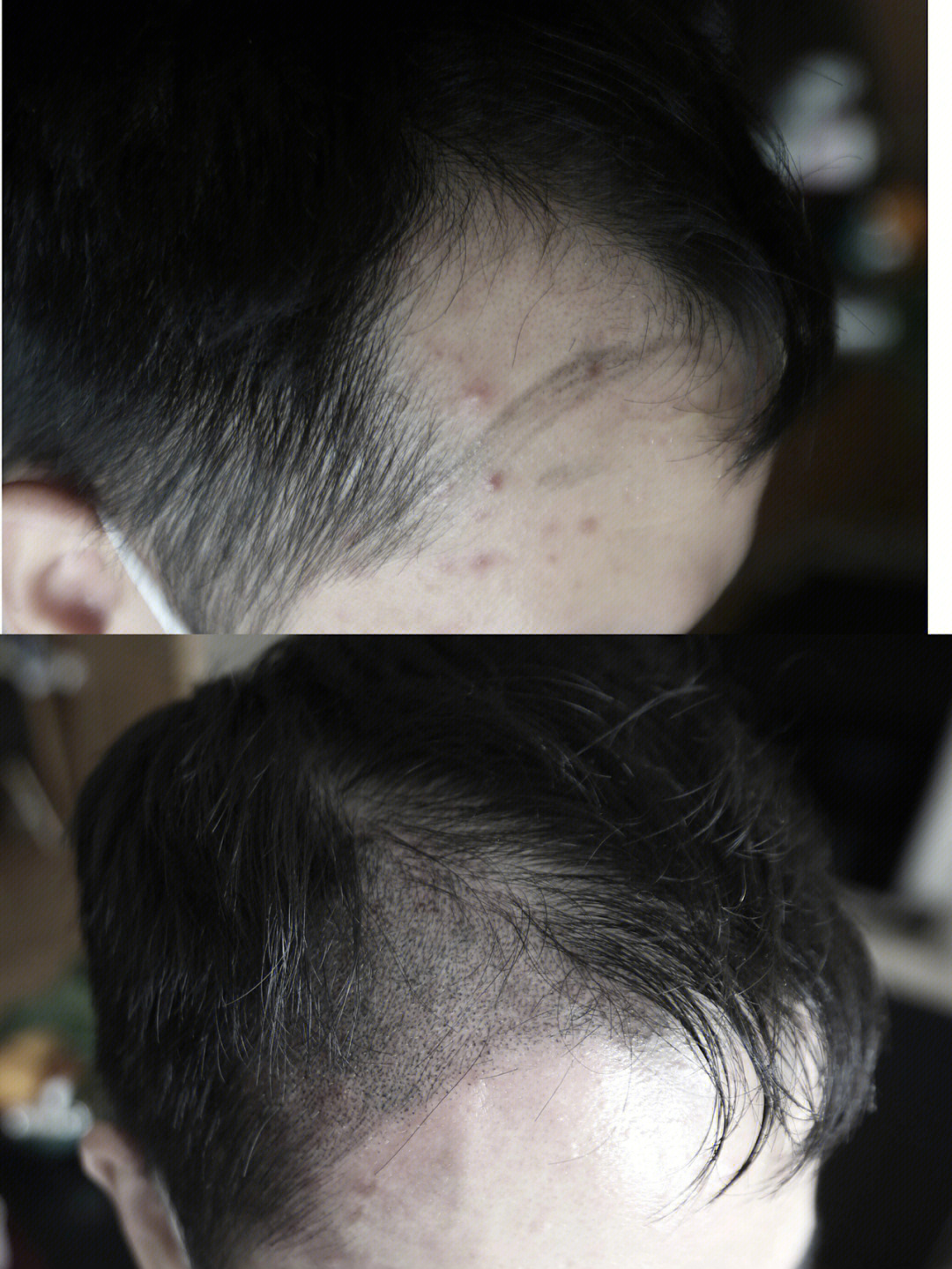 纹发一年效果图图片