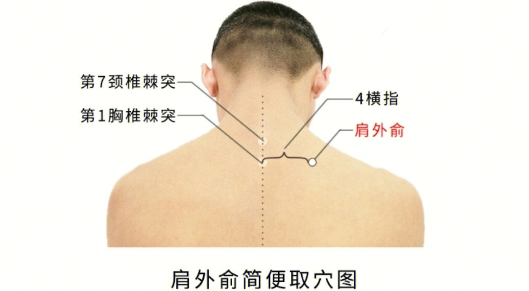 往下数一个椎体,为第1胸椎,旁开4横指,即为此穴肩外俞穴的位置在肩部