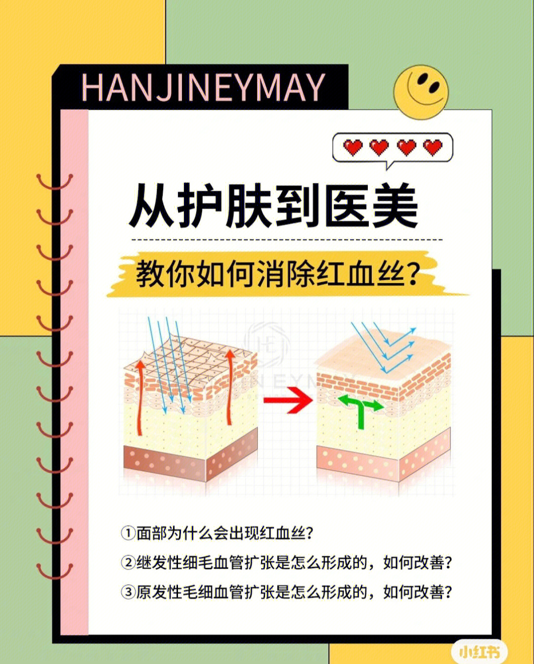 教你如何消除红血丝