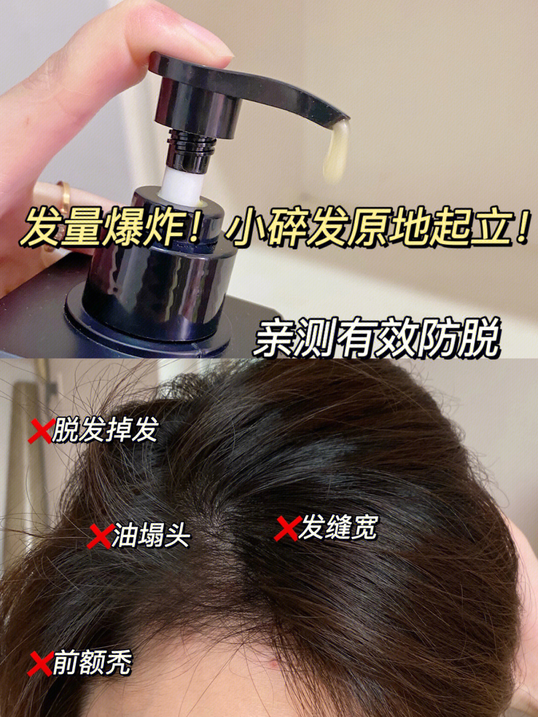 防脱洗发水千千万好用的真的不多,家人们作为一个秃头星人加上头发特