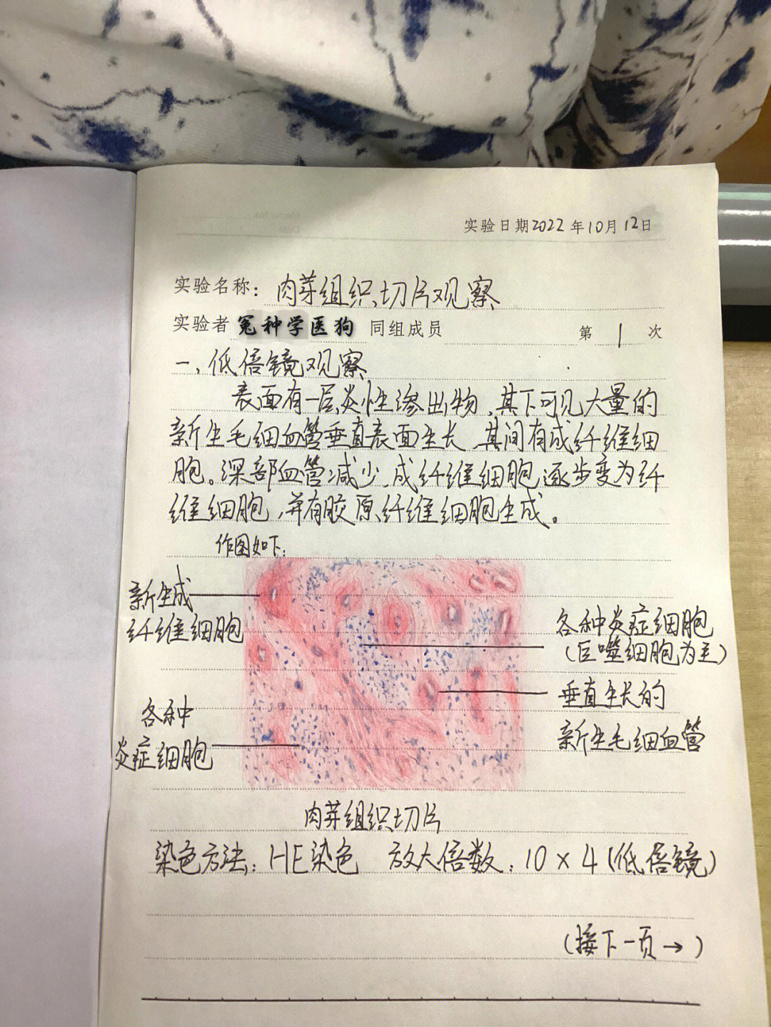 肉芽组织实验报告图片