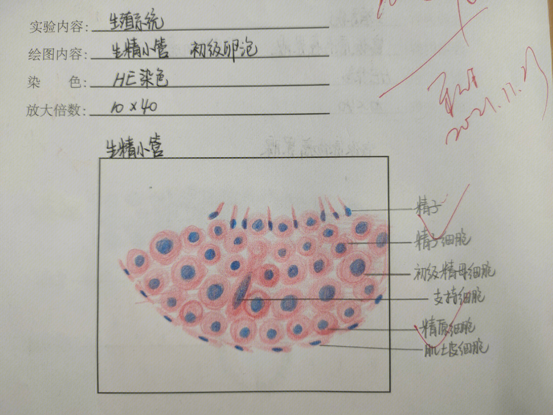 生殖系统红蓝铅笔绘图
