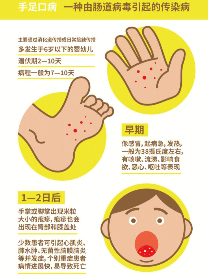 手足口病是怎么引起的图片