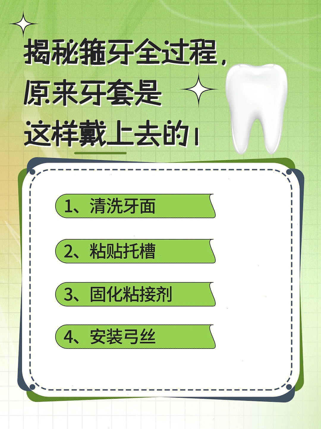 自锁托槽打开图解图片