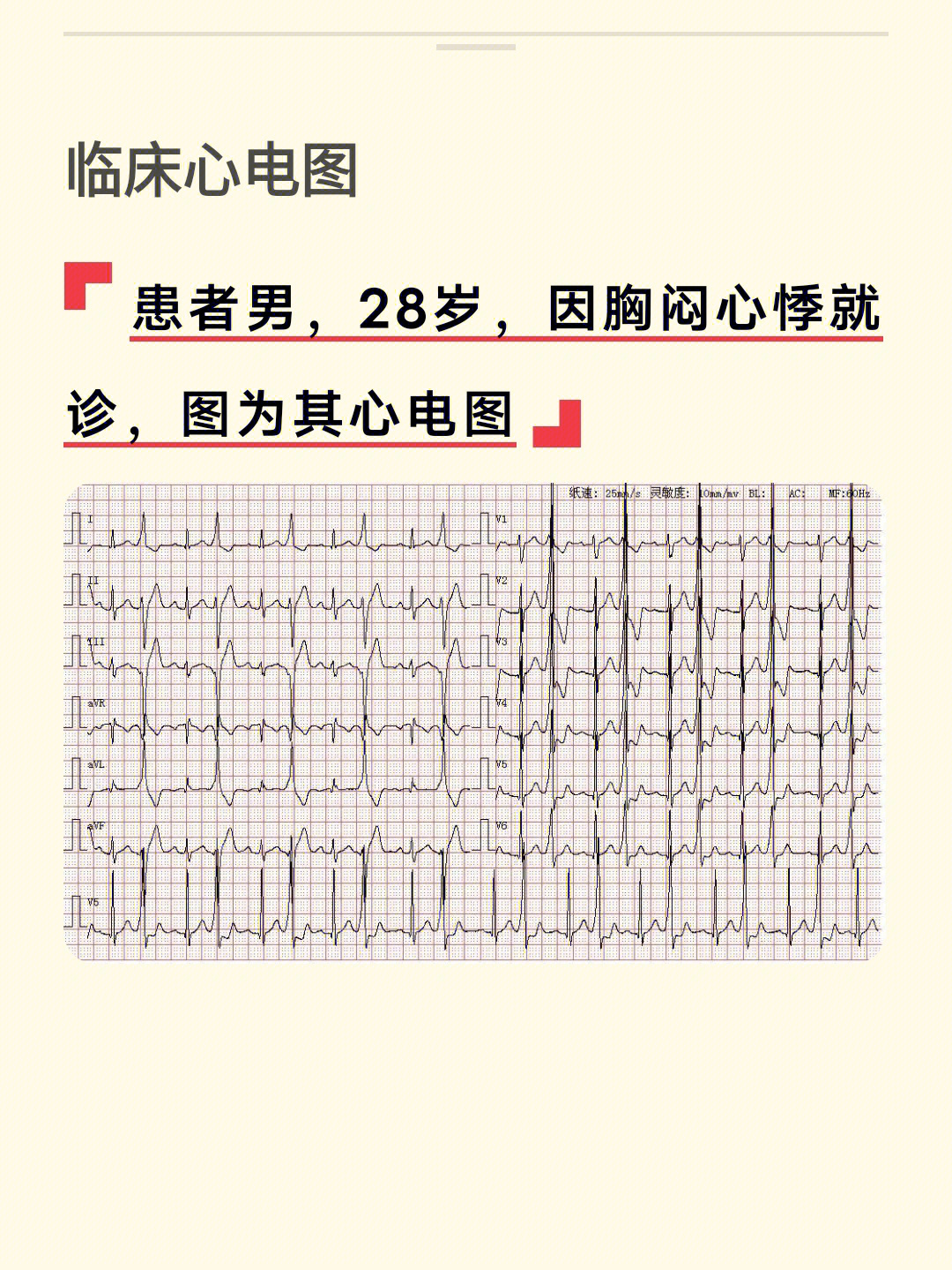 大家热烈讨论