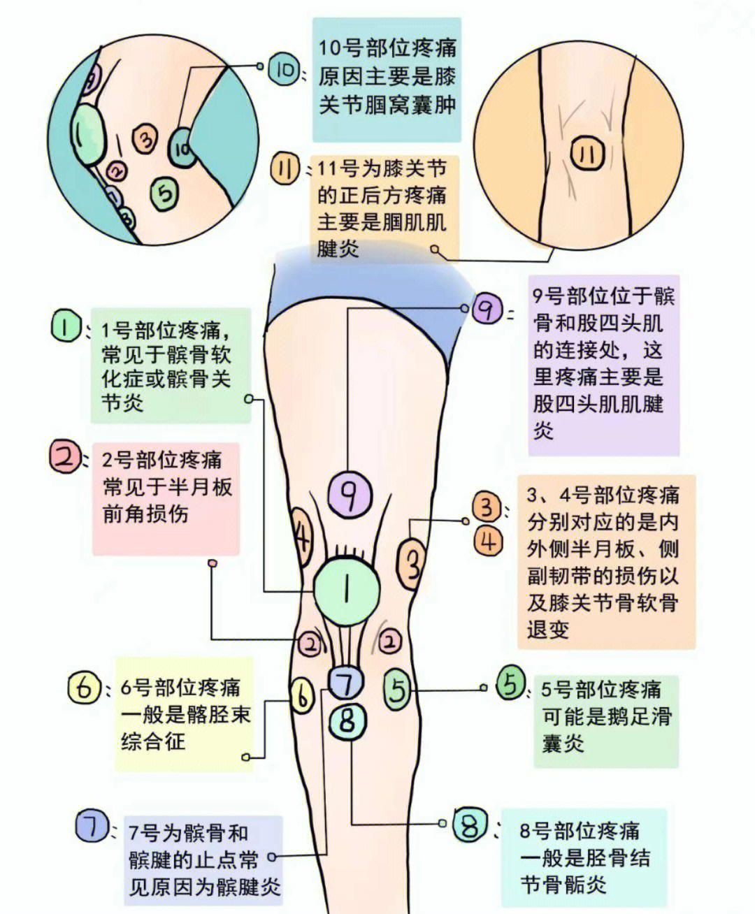 膝盖结构图 解剖图图片