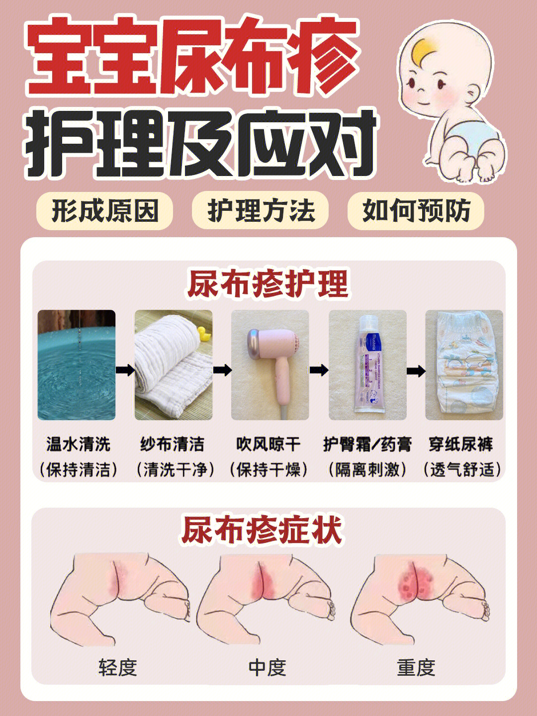 预防尿布疹从护理屁屁开始