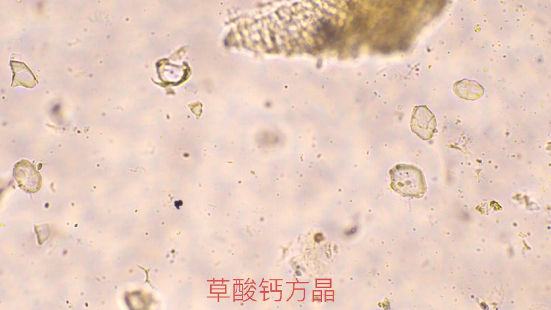 草酸钙方晶图片图片