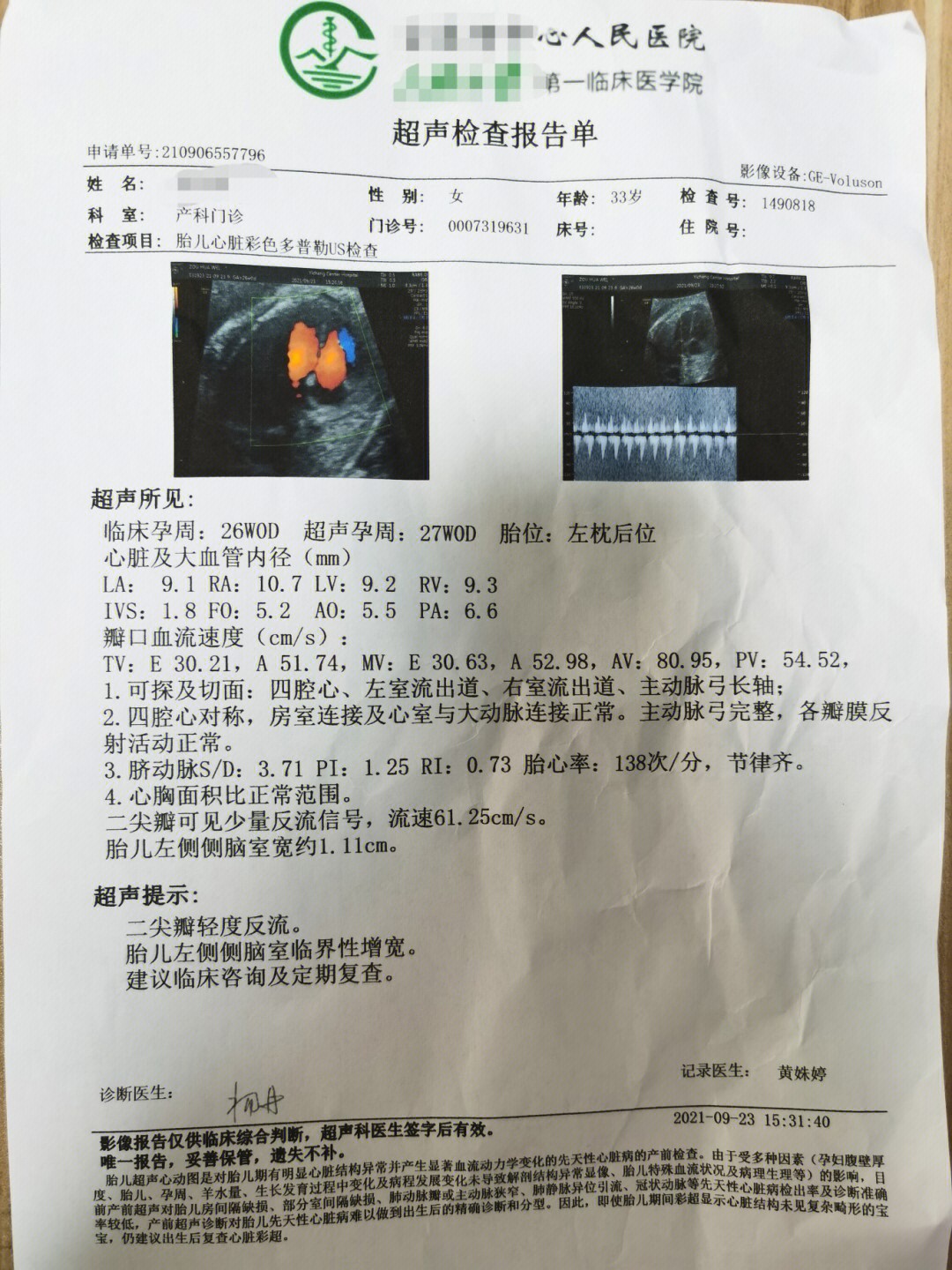 侧脑室增宽依然在相信宝宝会慢慢吸收