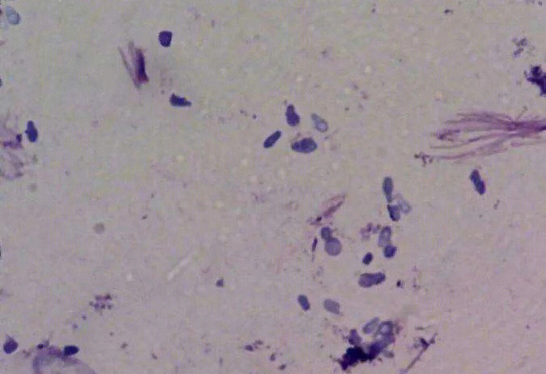 猫小孢子菌镜检图片图片
