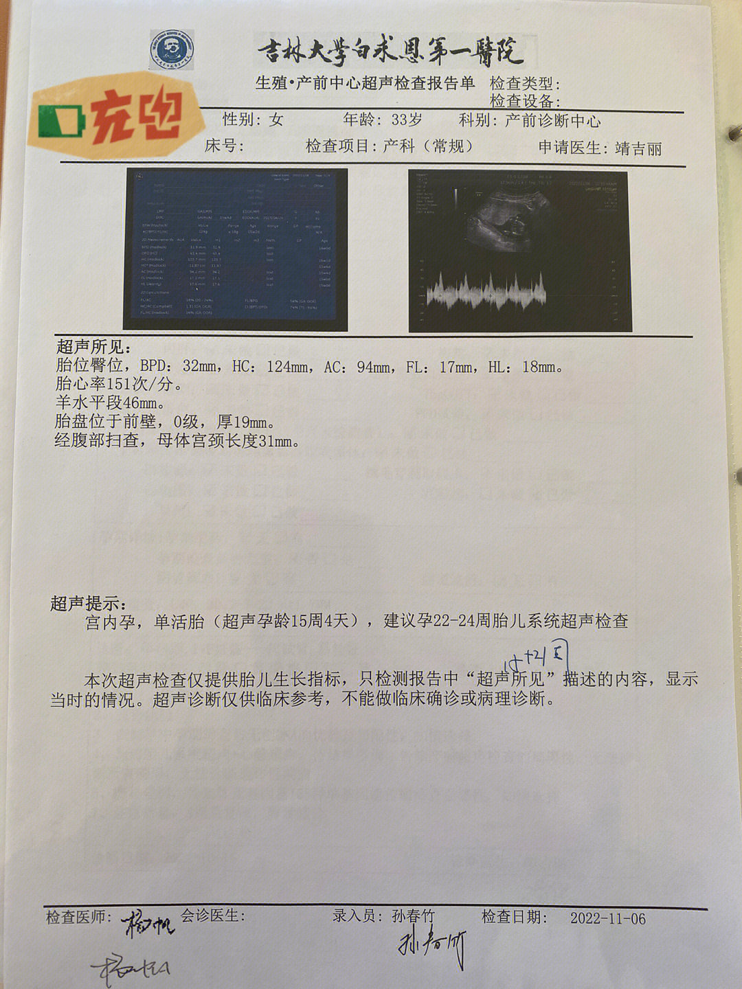 胎儿肱骨对照表图片