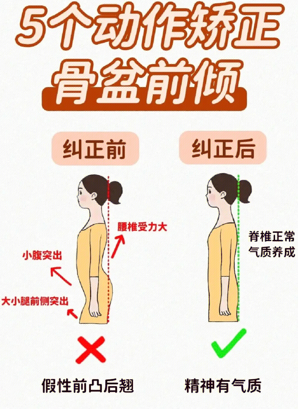 075个动作矫正骨盆前倾改善不良体态