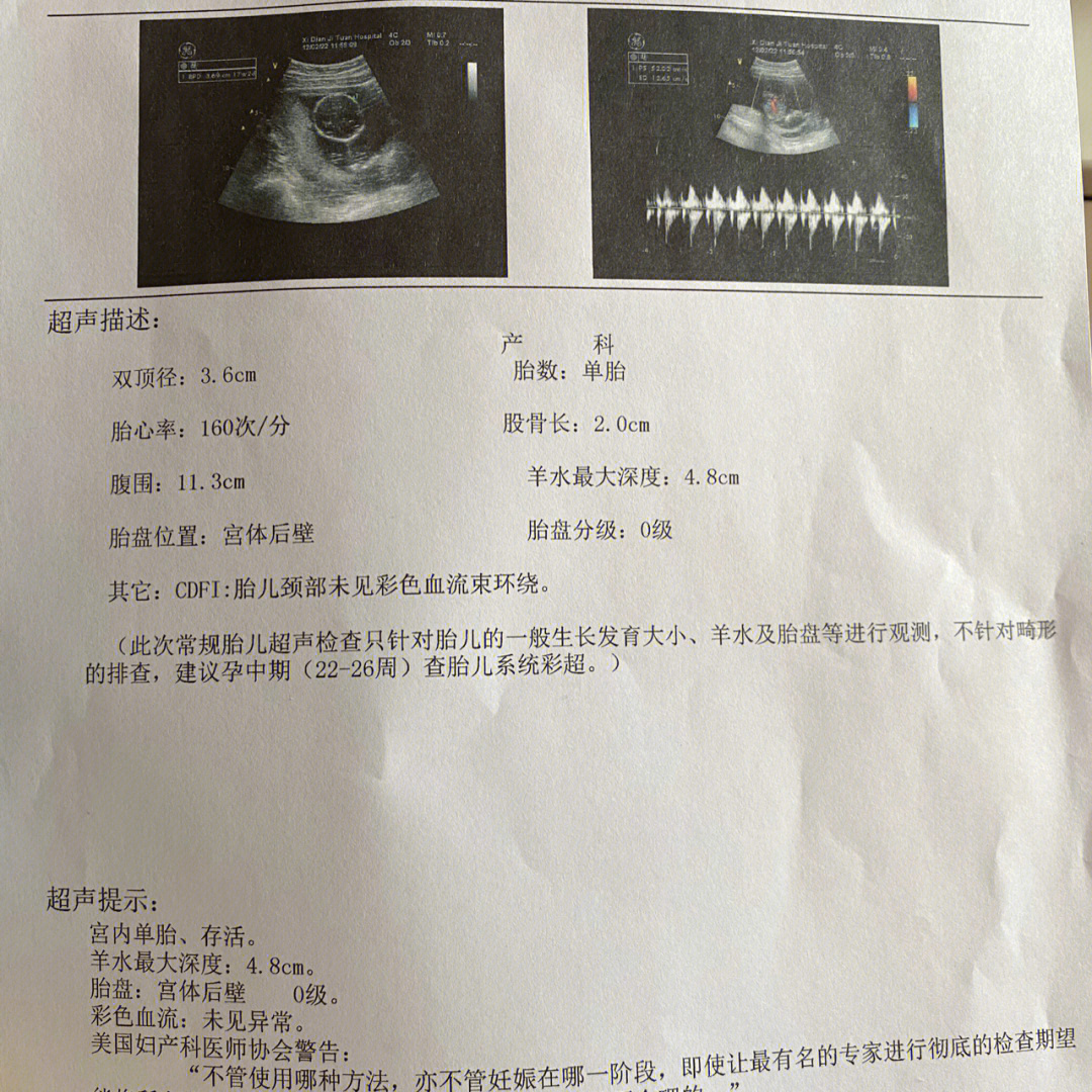 孕12周头臀径正常范围图片