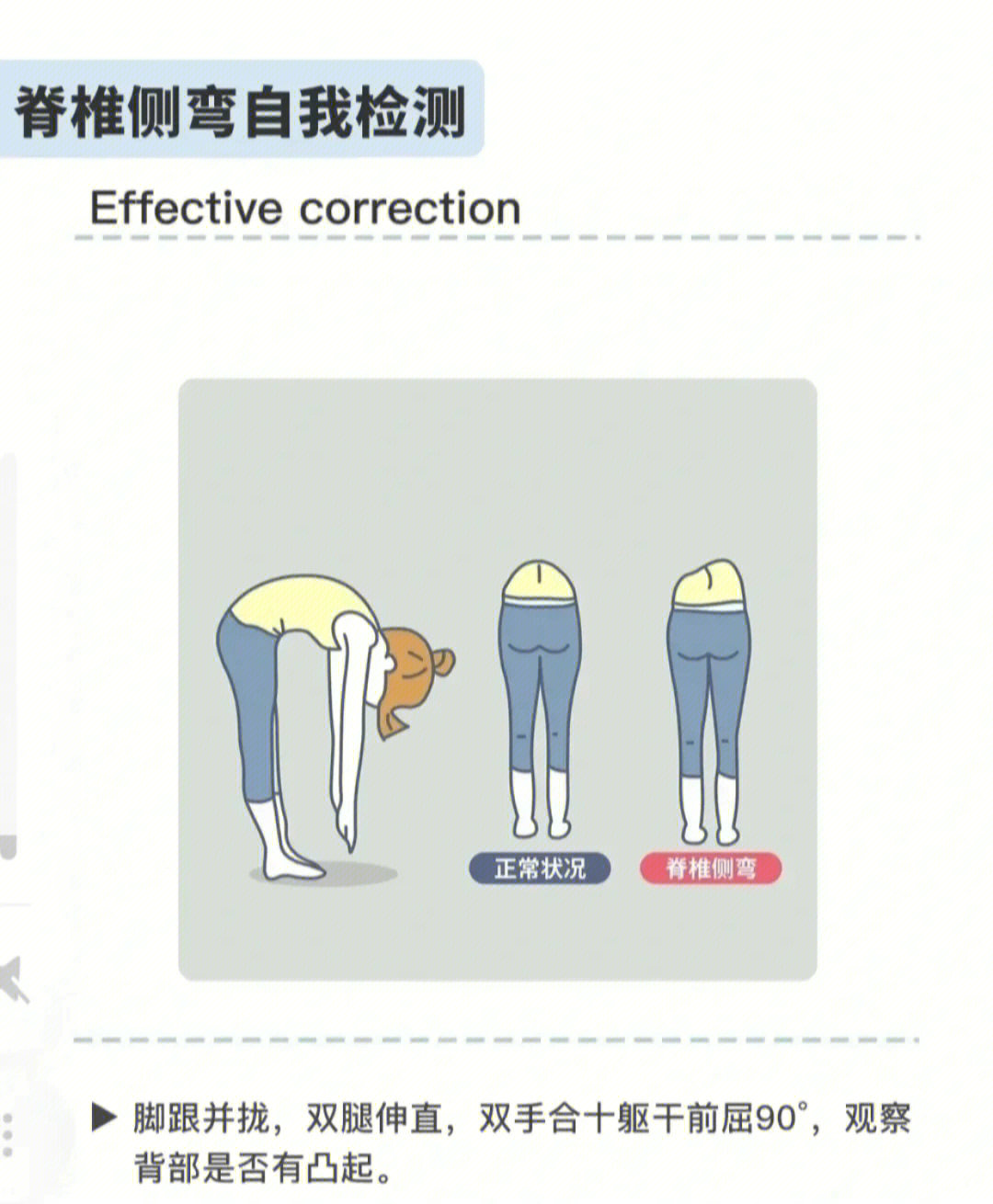 脊柱侧弯自我矫正法图图片