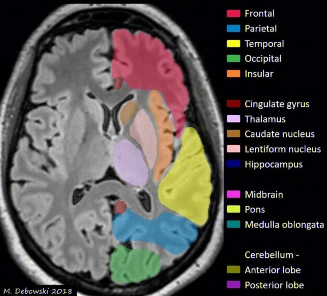 脑叶解剖分布