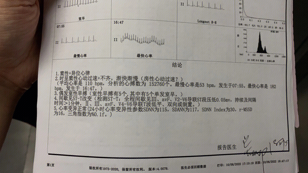 心率过快 年轻人要好好保重身体呀