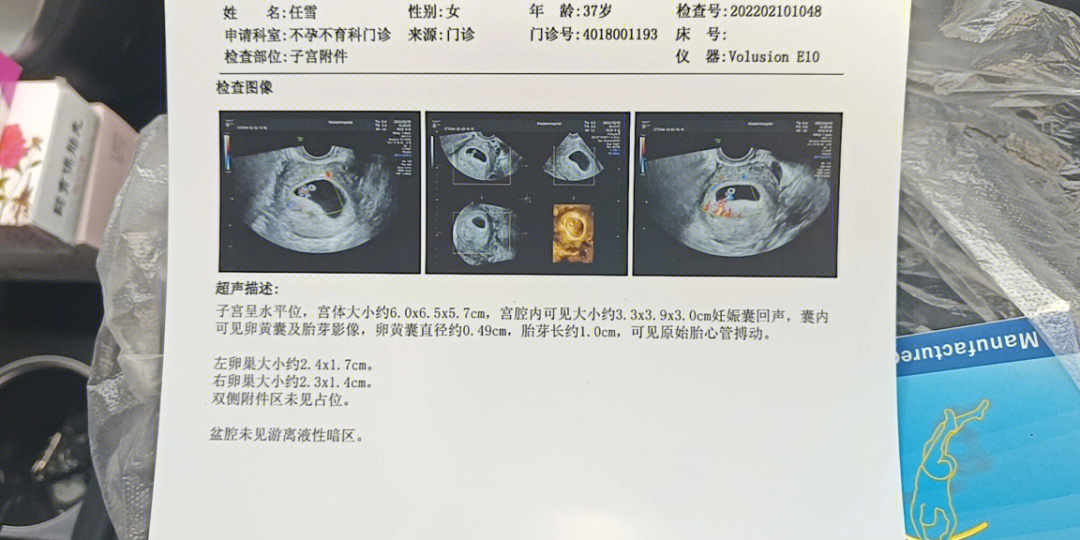 还要打孕酮针 直至怀孕80天 加油加油加油