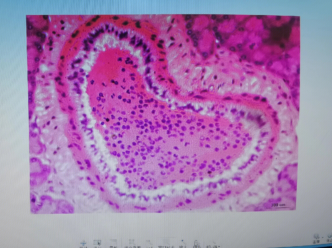 胰腺的光镜结构图片