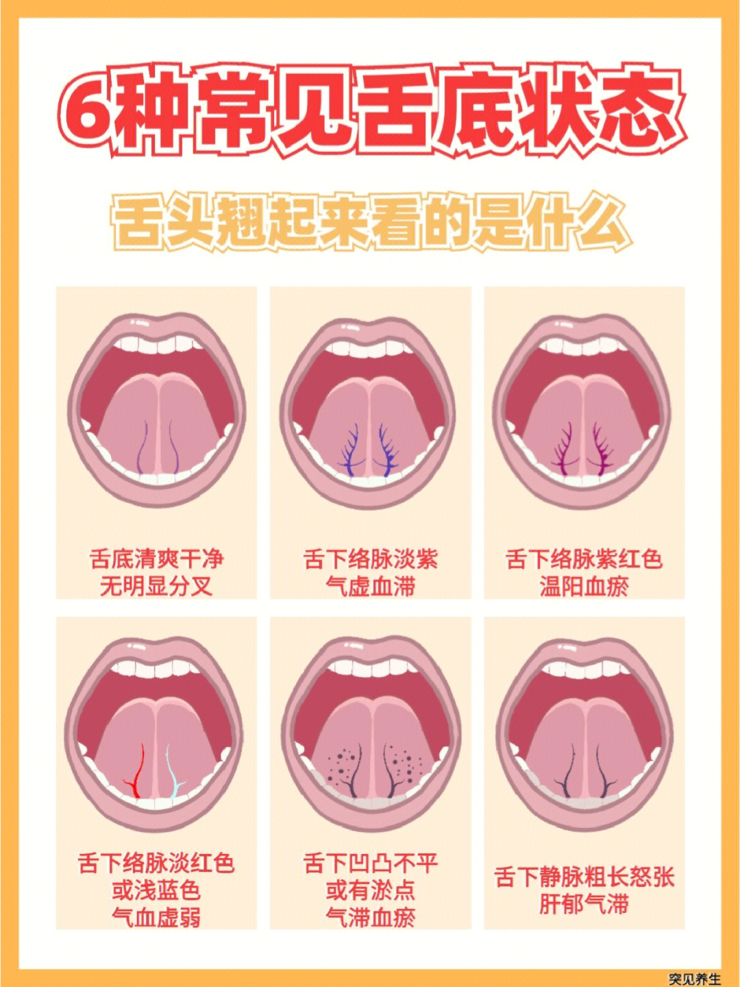 正常的舌头组织图图片