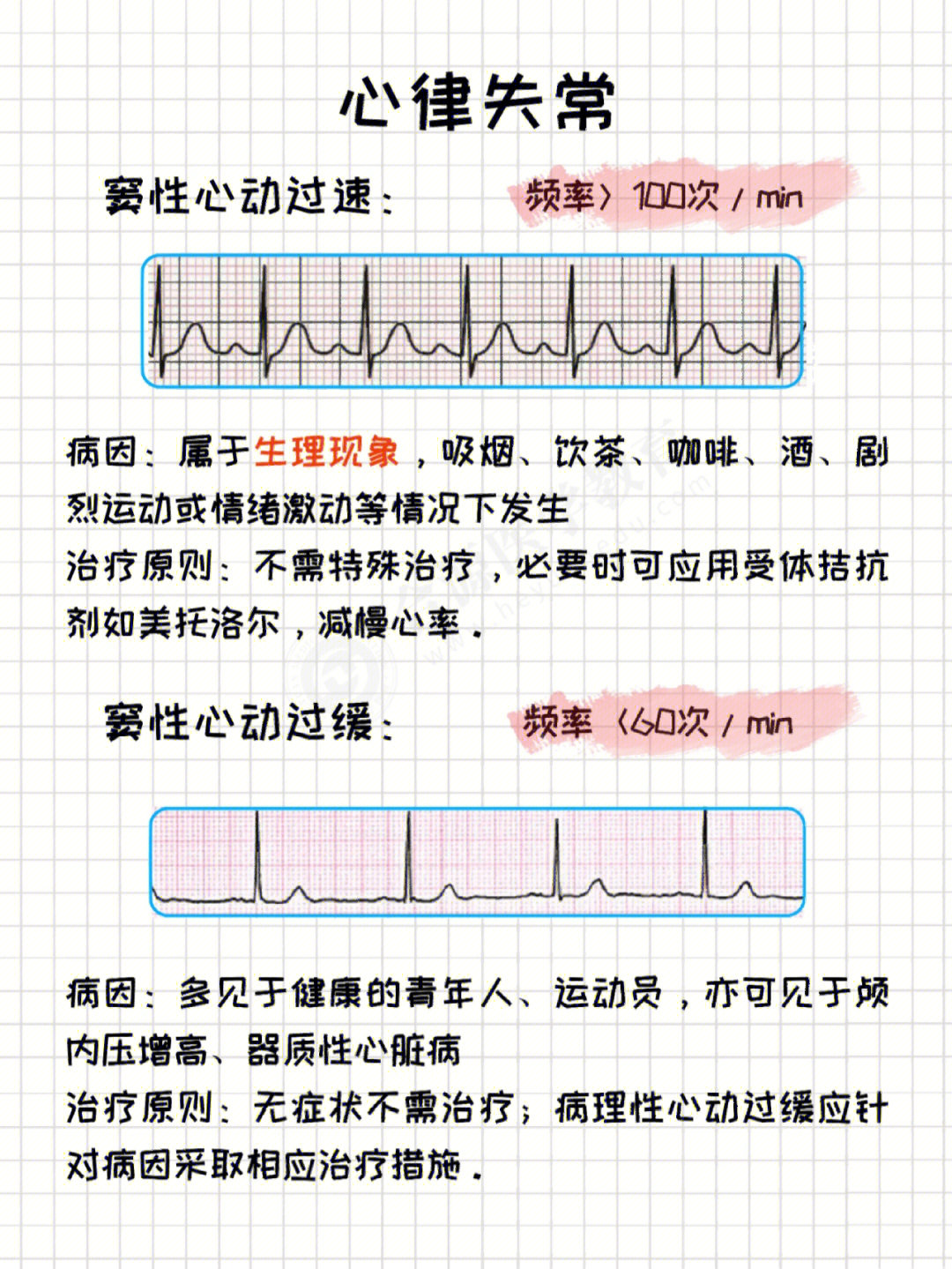 心动过速的原因及治疗图片