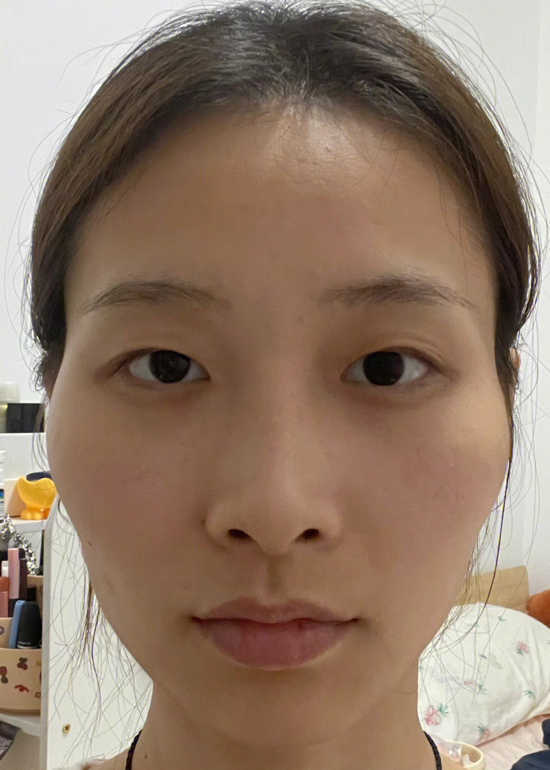 p1后置p1前置 左右脸不对称 波浪脸还有法子吗 听