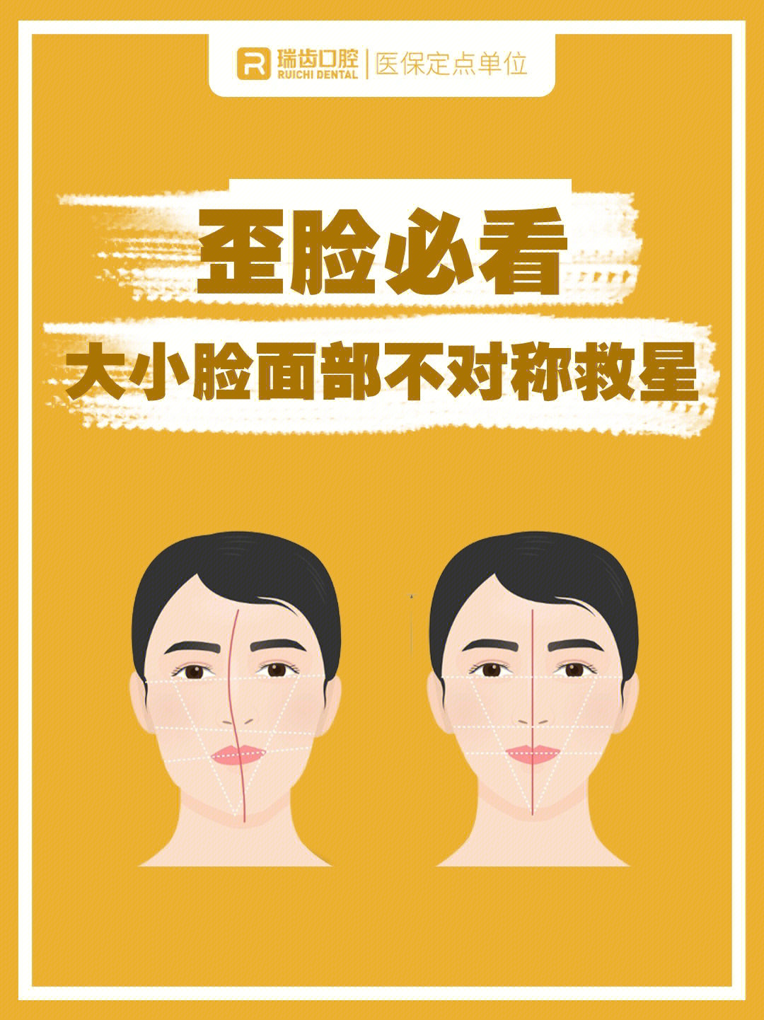 脸歪必看|大小脸、面部不对称有救了！
