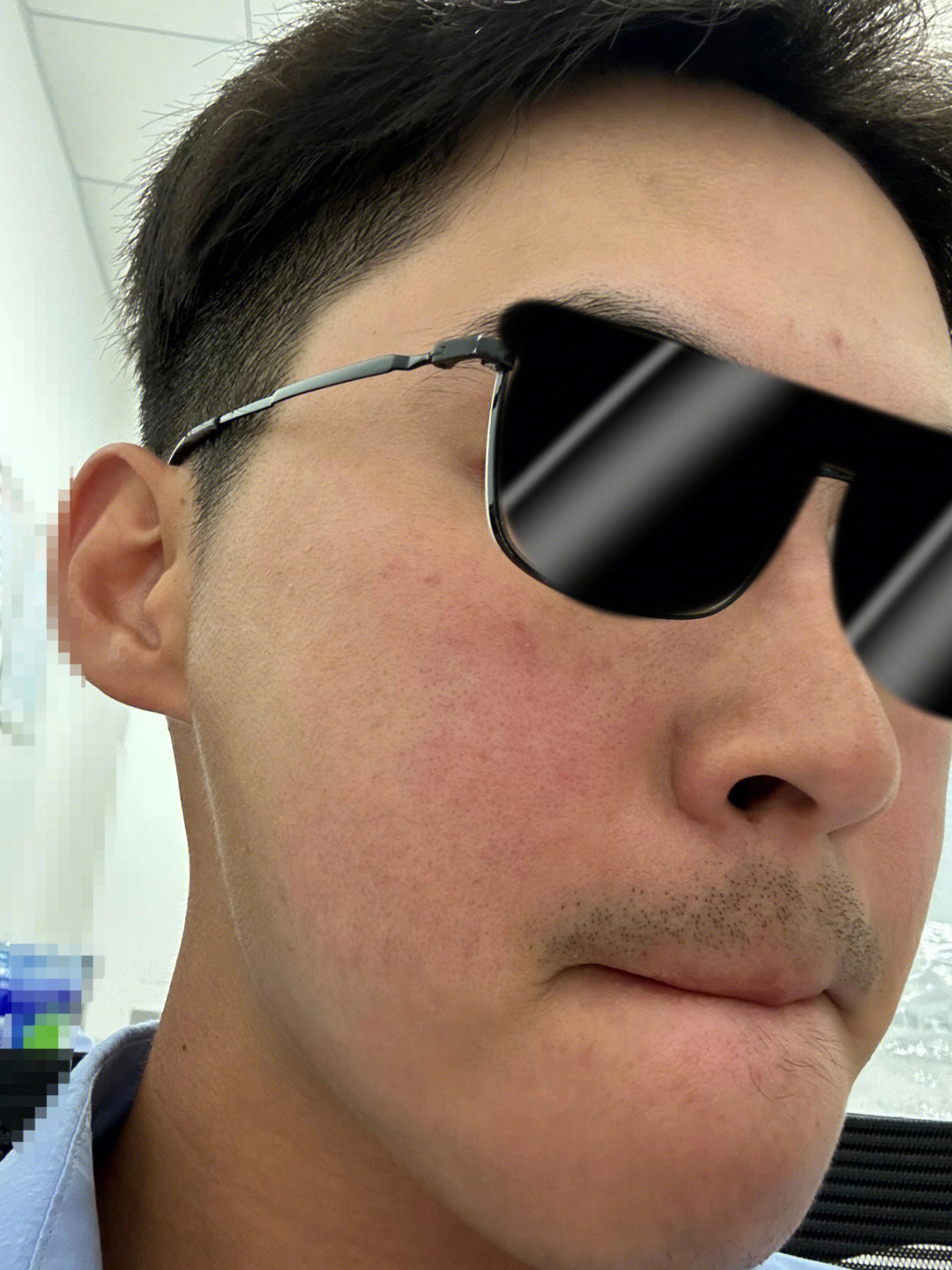 脸泛红一直不好怎么办呀？