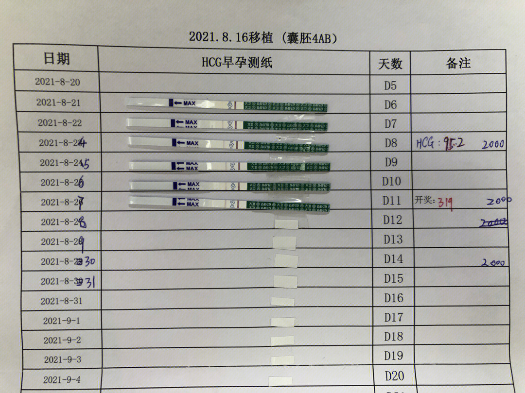 囊胚移植第11天,谈谈hcg2000单位针的看法