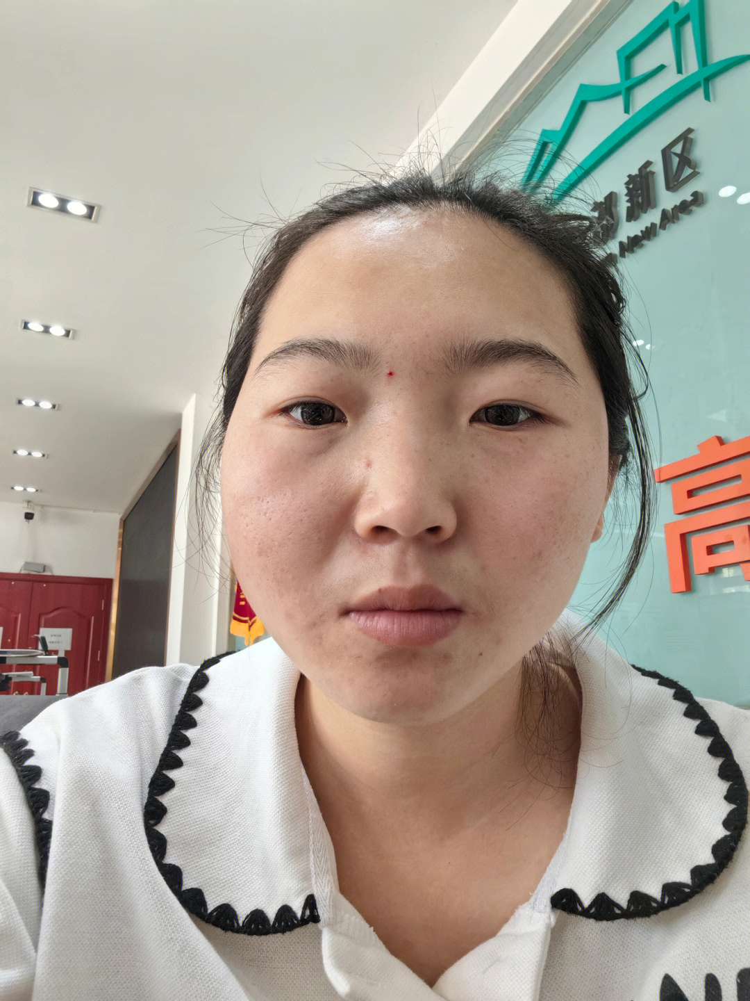 医美整形分享 | 大小脸
